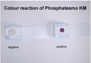 Sperma-Testpapier Phosphatesmo KM zum Nachweis der sauren Phosphatase, Dose a 25 Testpapiere 15 x 30 mm