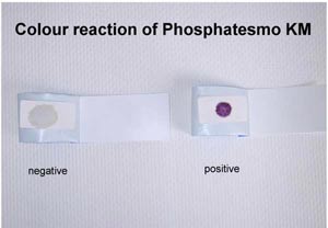 Sperma-Testpapier Phosphatesmo KM zum Nachweis der sauren Phosphatase, Dose a 2 Testpapiere 15 x 30 mm