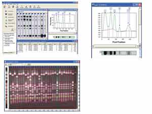 Phoretix 1D-Software fr die Geldokumentation<br>Laborbedarf,Elektrophorese,Geldokumentation,Software,DNA-Analyse