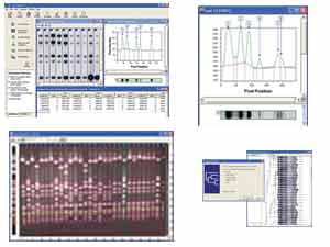 Phoretix 1D-Pro-Software fr die Geldokumentation<br>Laborbedarf,Elektrophorese,Geldokumentation,Software,DNA-Analyse