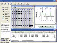TotalLab Quant Software fr die Geldokumentation<br>Laborbedarf,Elektrophorese,Geldokumentation,Software,DNA-Analyse
