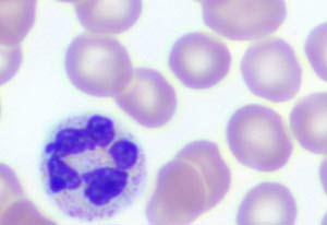 GIEMSA-Lsung, Stammlsung,  Frbelsung (Original), Frben von Blutausstrichen</p>GIEMSA solution, stock solution, staining solution (original), staining blood smears</p>Laborbedarf,Frbung,Frbelsungen,GIEMSA-Lsung