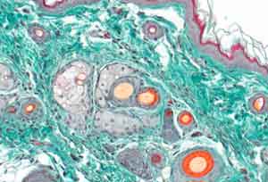 Frbekit: MASSON GOLDNER Trichrom mit allen bentigten Reagenzien zur Verwendung in der Histologie und/oder Zytologie zum Frben von Gewebeproben</p>Staining kit: MASSON GOLDNER Trichrome with all reagents required for use in histology and / or cytology for staining tissue samples